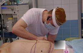 吸脂手术视频全过程,从术前准备到术后恢复